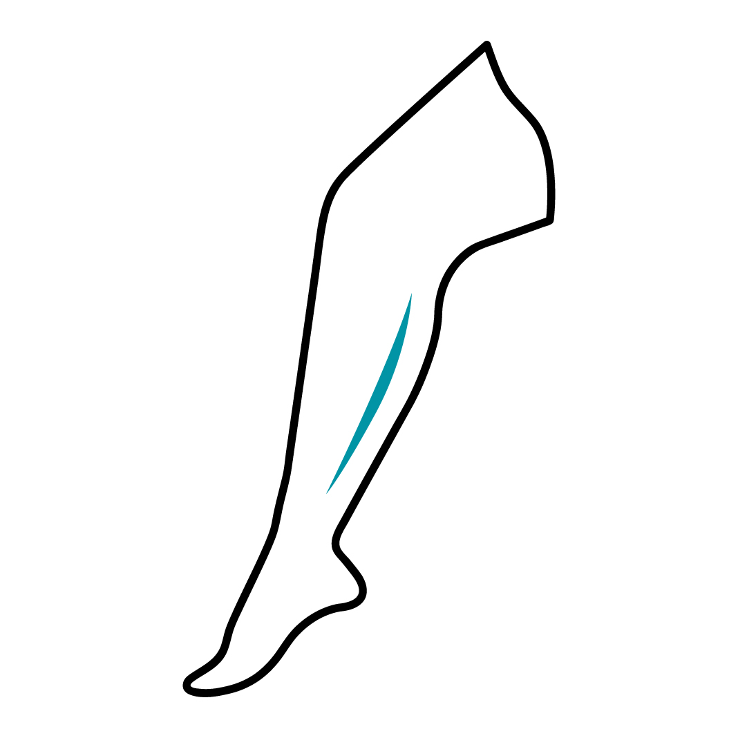 epilazione epilazione